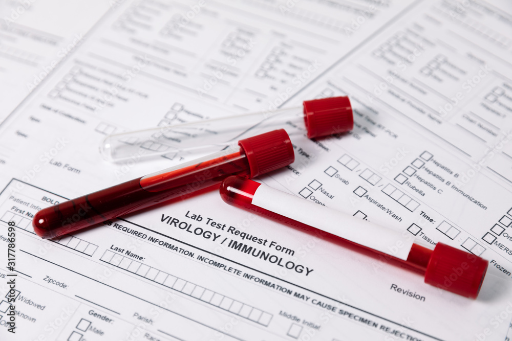 Test tubes with blood. nCov, Coronavirus test Test tubes with blood. nCov, Coronavirus test