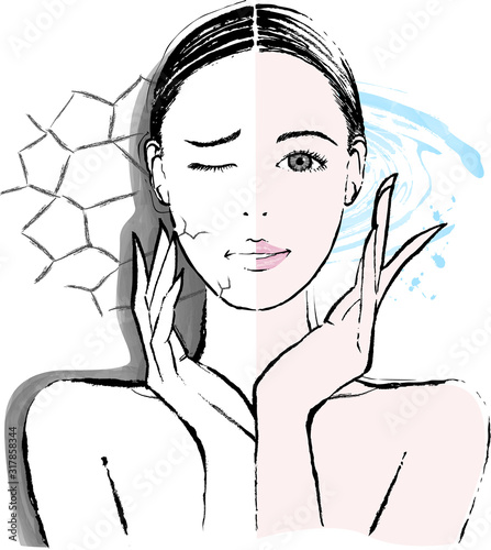 女性　乾燥肌　ビフォーアフター