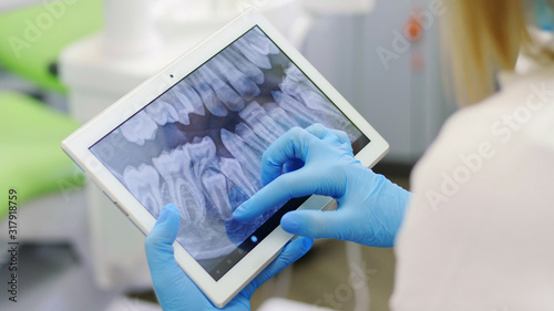 Dentist shows on the tablet x-ray teeth, close-up. Modern dentistry. X-ray of the teeth on a portable device