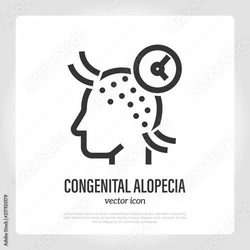 Congenital alopecia thin line icon. Hair loss. Bald place on scalp. Vector illustration.