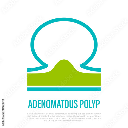 Adenomatous polyp in intestine. Benign tumor. Thin line icon. Healthcare and medical vector illustration.