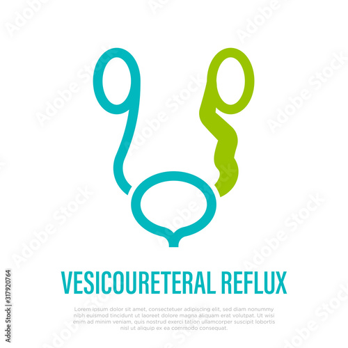 Vesicoureteral reflux. Urine flows backward from bladder into kidneys. Thin line icon. Healthcare and medical vector illustration.