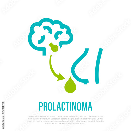 Prolactinoma thin line icon. Benign tumor, adenoma. Hyperprolactinemia. Healthcare and medical vector illustration.