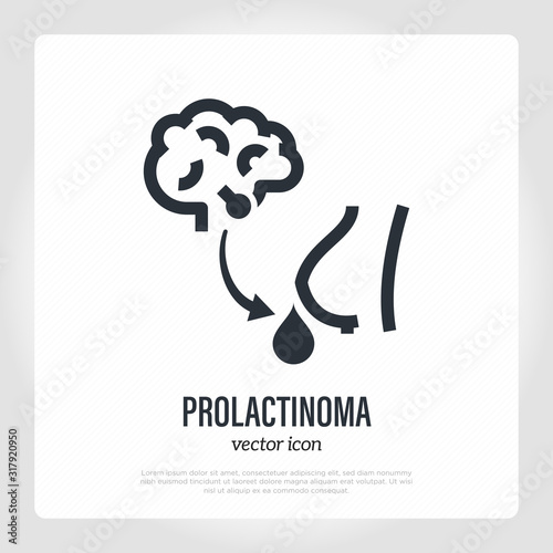 Prolactinoma thin line icon. Benign tumor, adenoma. Hyperprolactinemia. Healthcare and medical vector illustration.