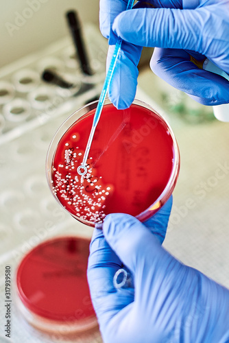 Petri dishes with bacterial colonies