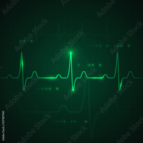 Heart pulse on green display. heartbeat graphic or cardiogram. Hospital monitoring stress rate. Vector