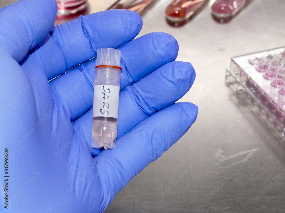 New coronavirus 2019-nCoV in laboratory New coronavirus 2019-nCoV in laboratory
