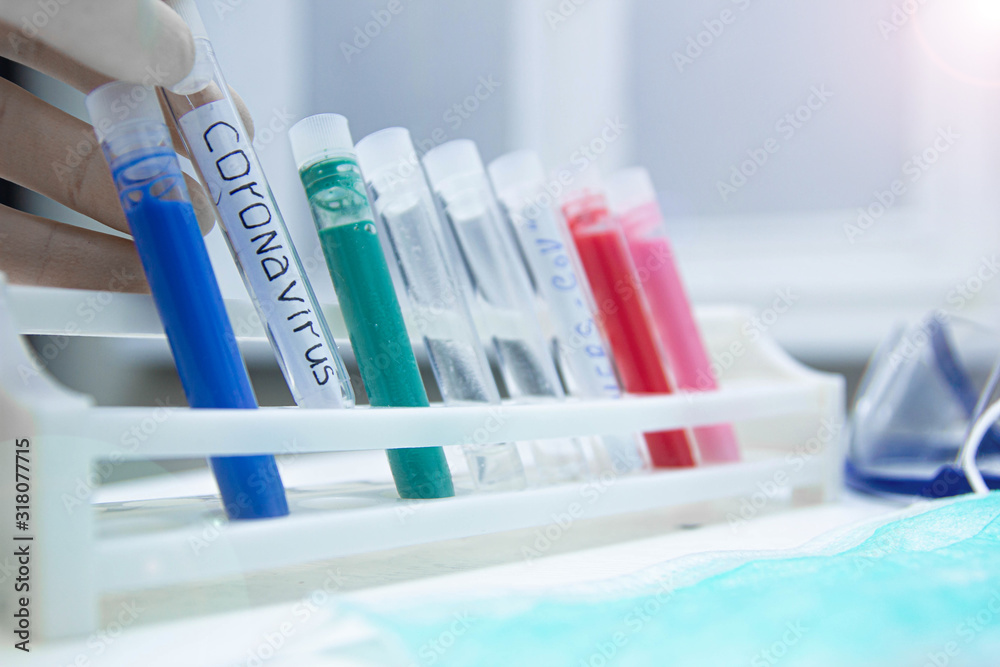 test tube coronavirus, experiments in search of a vaccine. test tube coronavirus, experiments in search of a vaccine.