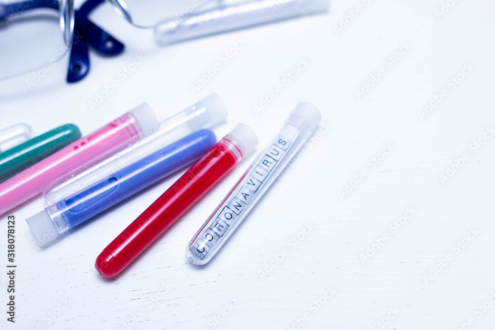laboratory test tube coronavirus diagnosis concept laboratory test tube coronavirus diagnosis concept