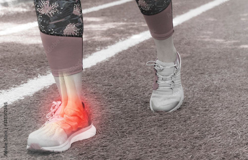 Ankle injury and Joint pain-Sports injuries