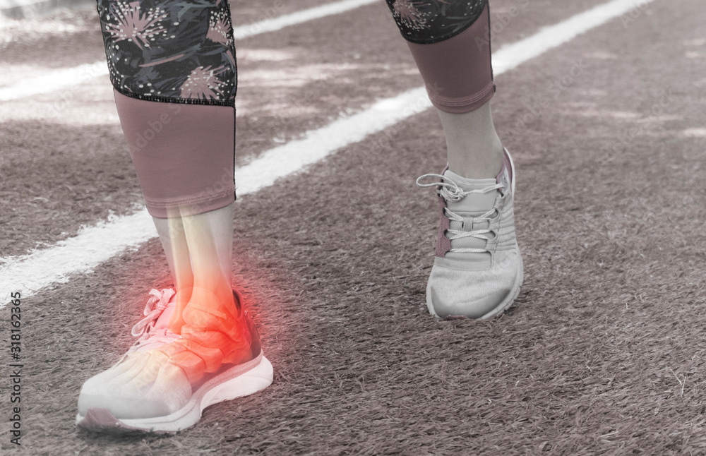 Ankle injury and Joint pain-Sports injuries Ankle injury and Joint pain-Sports injuries