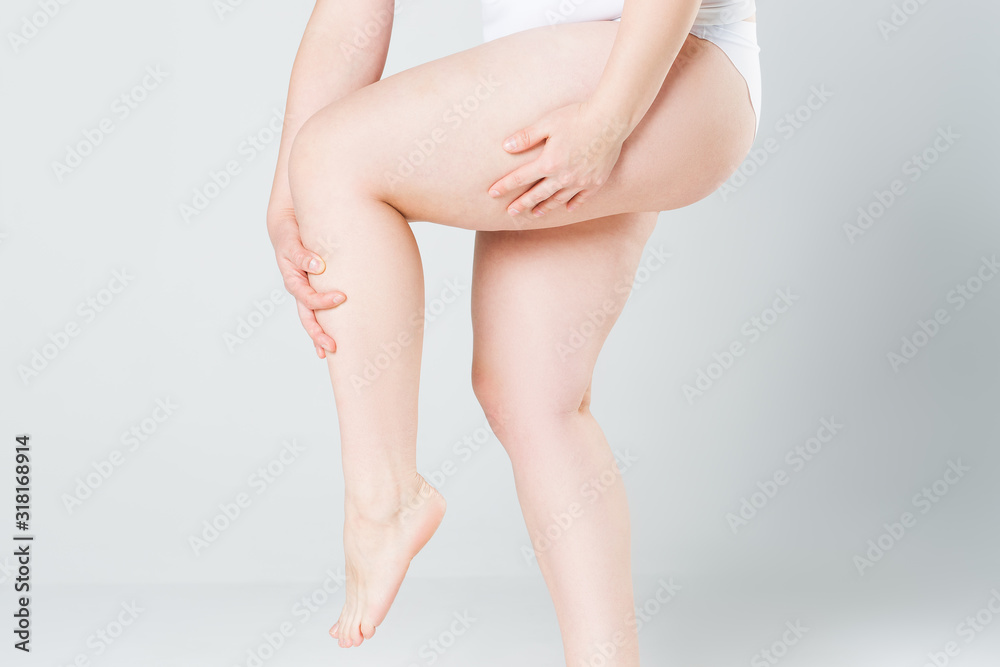 Overweight woman with fat thighs, obesity female legs on gray background Overweight woman with fat thighs, obesity female legs on gray background