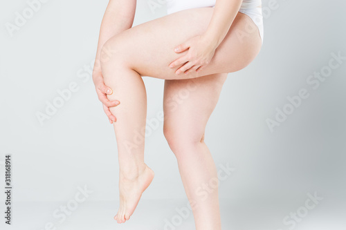 Overweight woman with fat thighs, obesity female legs on gray background photo