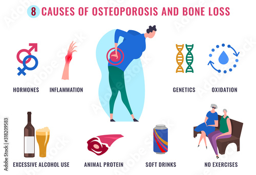 Osteoporosis Infographic Poster