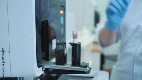 professional medicine research. test tubes blood glasses are getting inserted into a biochemical analyzer by a lab worker medical scientist
