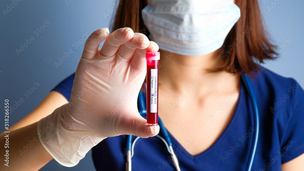 Nurse holding test tube with Positive Coronavirus test blood sample. 2019-nCoV pandemic, Novel Chinese Coronavirus, Wuhan Coronavirus blood analysis concept. Nurse holding test tube with Positive Coronavirus test blood sample. 2019-nCoV pandemic, Novel Chinese Coronavirus, Wuhan Coronavirus blood analysis concept.