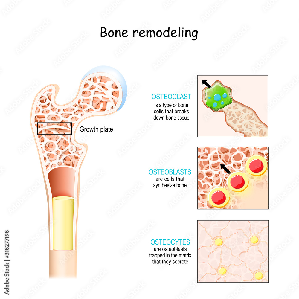 Bone Remodeling Unveiled Mastering Osteoclast Characteristics - wztsmi5