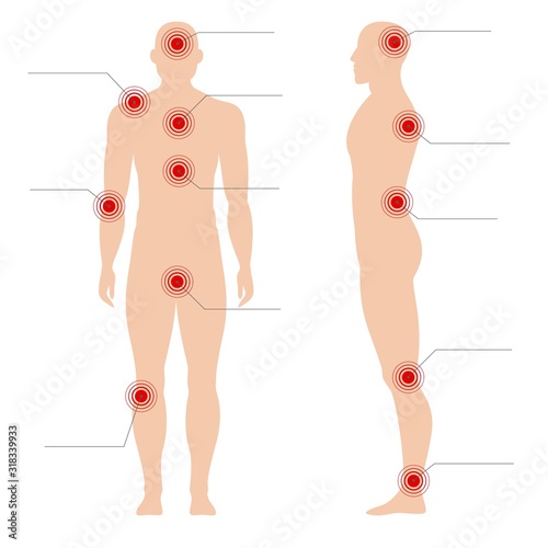 Man body with pain points. Circle painful red spot point on human silhouette vector medical abstract illustration