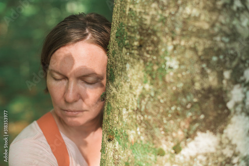 Woman is hugging tree trunk in forest