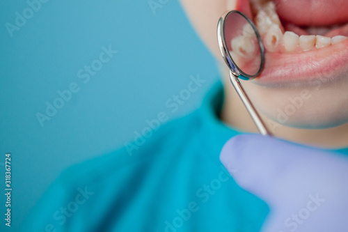 Fototapeta Naklejka Na Ścianę i Meble -  Close up of dentist's hands with assistant in blue gloves are treating teeth to a child, patient's face is closed