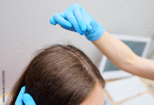 a dermatologist trichologist examines the hair of a young woman patient. Trichology is the science of the condition and structure of hair. Hair health.