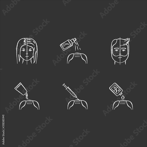 Hair loss chalk white icons set on black background. Male alopecia. Female balding. Haircare, dermatology. Products for hairloss. Injection for regrowth. Isolated vector chalkboard illustrations