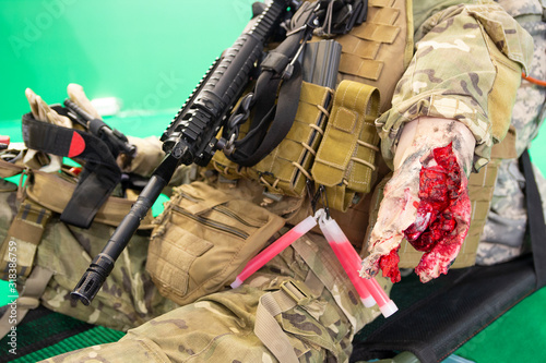 Fotografía Mannequin of a wounded fighter with a severe wound on a stretcher