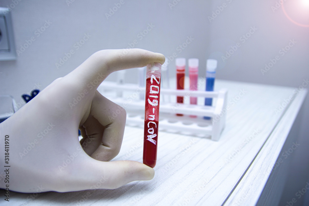 epidemic test and analysis coronavirus 2019-nCoV, a vaccine and a cure for the virus appeared in Wuhan, China