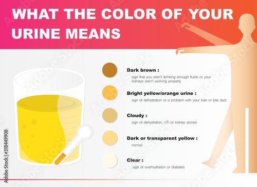 The color of urine can tell the health.