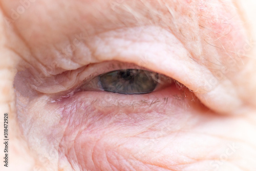Close-up. Woman aged. Eye in the center of the frame. The pupil has soft focus, the concept of poor eyesight, everything is blurry