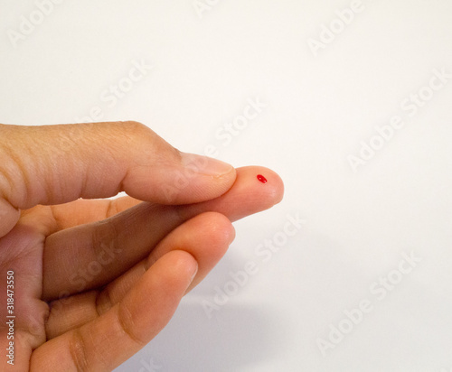 Fotografía A needle stick injury in work place