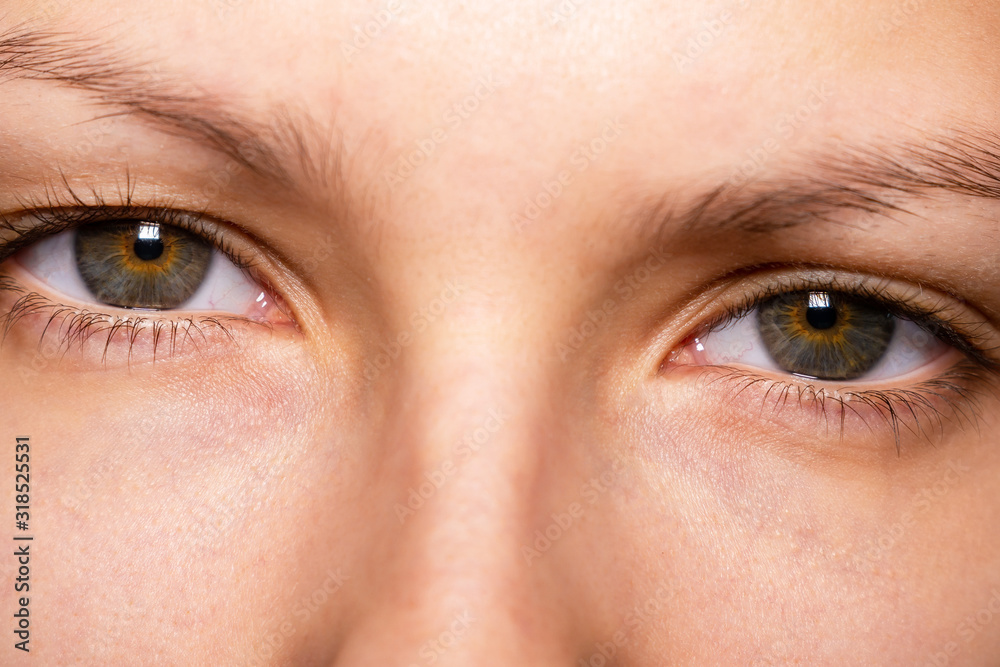 Obraz premium Gray, brown eyes, Sector heterochromia, looking at the camera. Portrait of a young woman, teenager