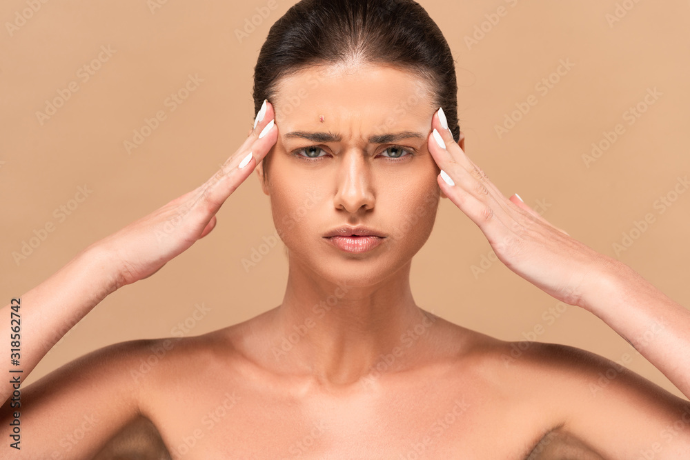 Naklejka premium focused and naked woman with pimple on face touching temples isolated on beige