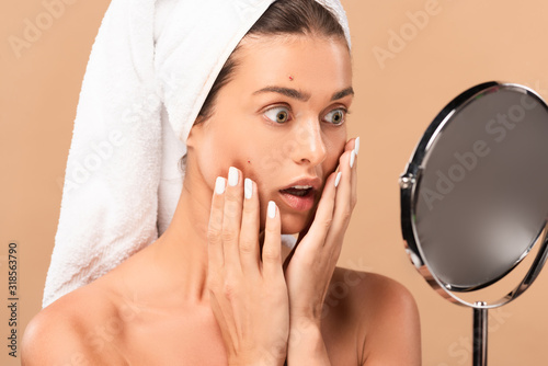 surprised naked girl touching face with pimples and looking at mirror isolated on beige photo