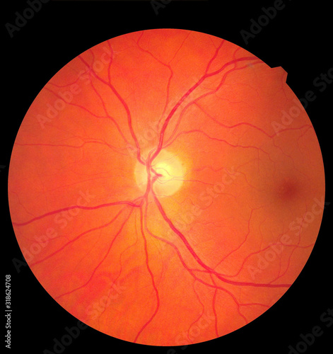 Ophthalmic image detailing the retina and optic nerve inside a healthy human eye. Medicine concept