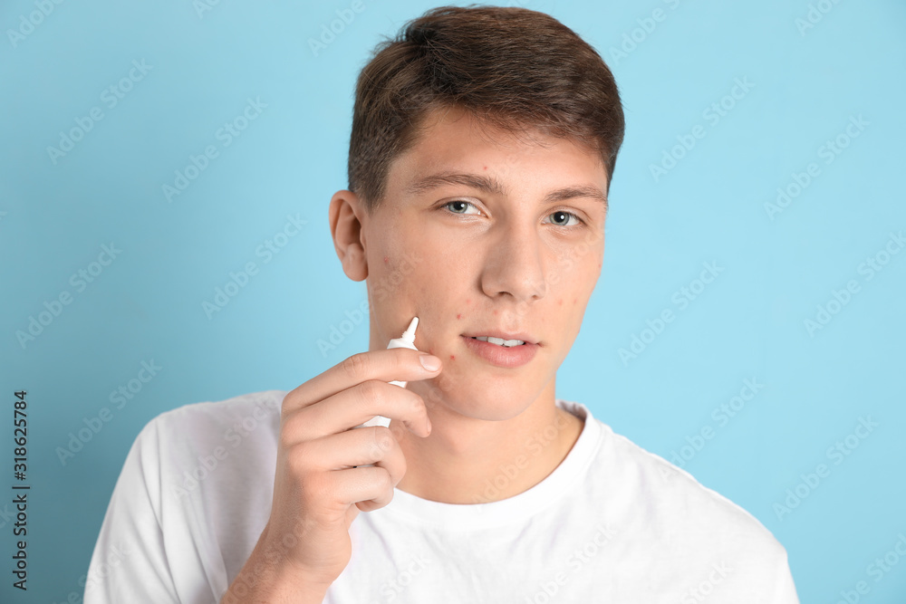 Teen guy with acne problem applying cream on light blue background Teen guy with acne problem applying cream on light blue background