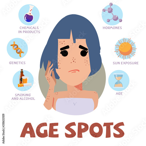 age spots infographic - vector illustration