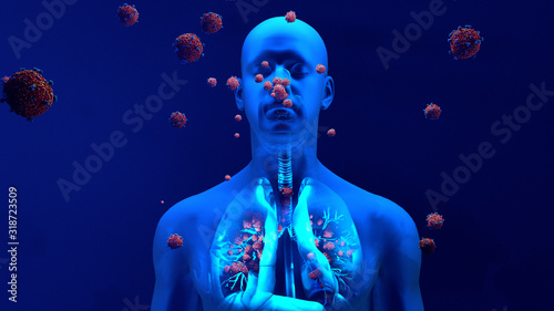 Droplets infected with a virus spray into the air, Human lungs infected by the Coronavirus or by virus, Respiratory infection caused by a virus. SARS