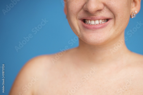 Beautiful smile of a young woman. White teeth according to the general plan. Free space and background to use.