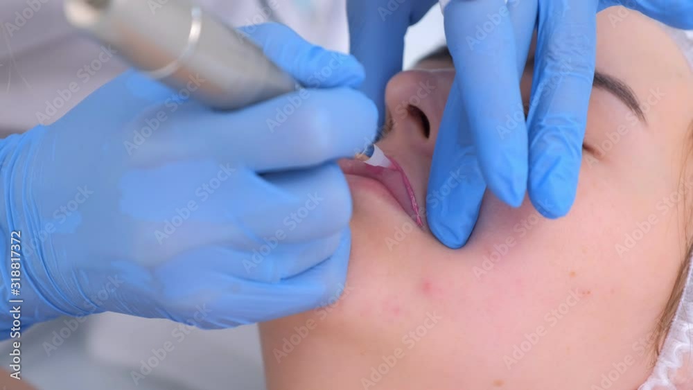 Cosmetologist is applying permanent makeup on woman lips using tattoo machine in clinic. Beautician hands and patient face closeup. Lips microblading procedure for girl. Beauty industry concept. Cosmetologist is applying permanent makeup on woman lips using tattoo machine in clinic. Beautician hands and patient face closeup. Lips microblading procedure for girl. Beauty industry concept.