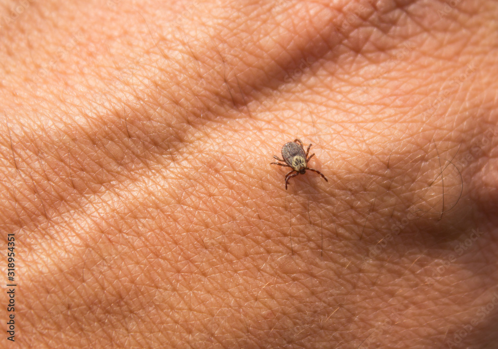 Obraz premium Spring mite crawls a male hand close-up