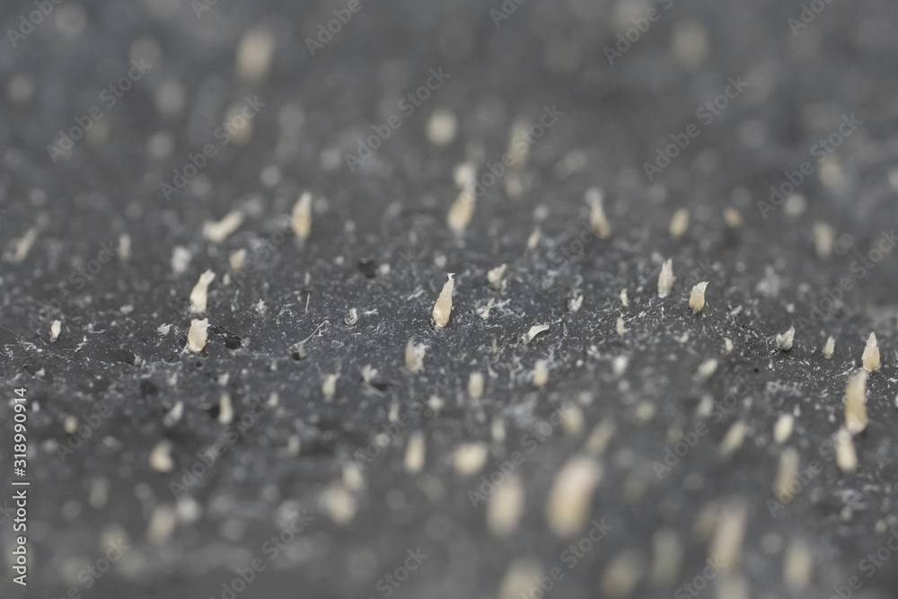 Close Up on Nose Acne on Blackhead Remover Pore Strips Close Up on Nose Acne on Blackhead Remover Pore Strips