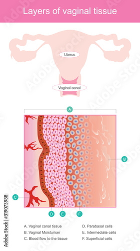 Layers of vaginal tissue. Vaginal walls is elastic tissue layers thick, moist, and have the blood flow that good. Illustration healthcare and medicine.