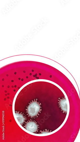 2019-nCoV Coronavirus close-up pathogen in petri dish virus analysis in laboratory background title design photo