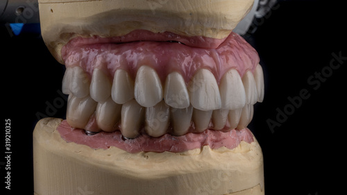 dental implants on a black background