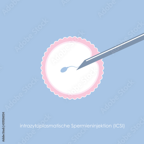 fertility reproduction of ovum and spermatozoon ICSI vector illustration EPS10