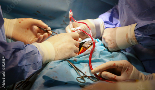 Canvastavla We work with a valve. Valve Replacement. Heart surgery.