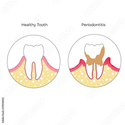 Vector isolated illustration of tooth 