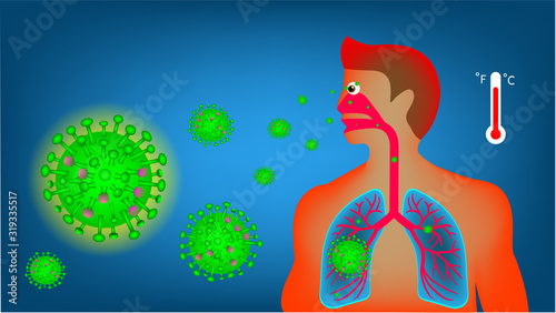 The cartoon illustration picture of the human body when catching the virus into their body. (vector )