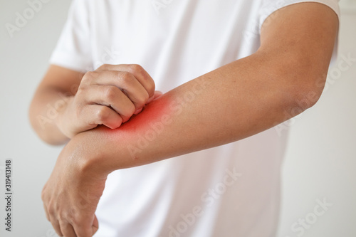 man itching and scratching on arm from itchy dry skin eczema dermatitis photo